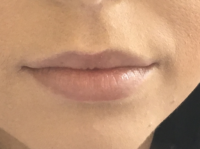 lips before Shot