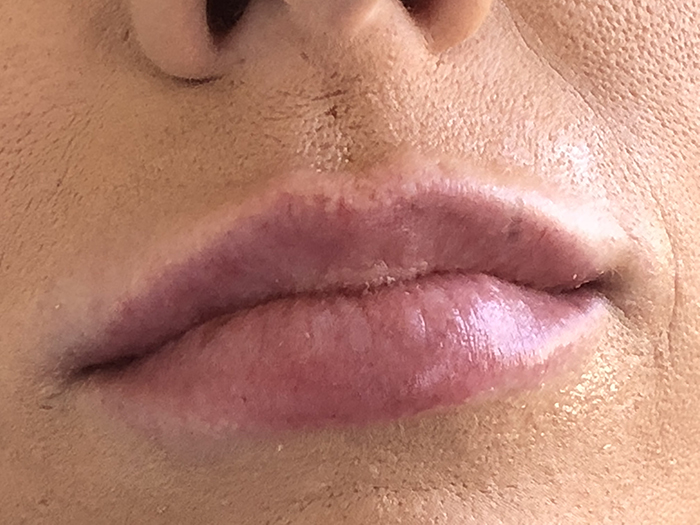 Photo Feb 09, 11 18 45 AM Close-up of enhanced lips showcasing natural fullness and smooth texture, part of Envie Skin and Body's lip enhancement treatment results.