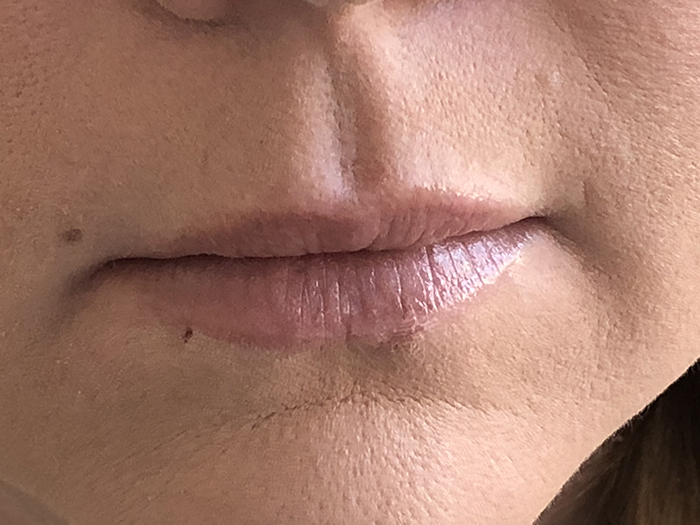 Photo Feb 09, 9 27 42 AM Close-up of lips after enhancement treatment, showcasing fuller and smoother appearance, highlighting results of lip augmentation at Envie Skin and Body.