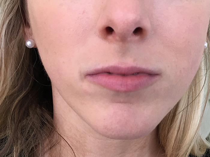 Photo Jan 02, 2 06 11 PM Close-up image of a woman's lips, showcasing a natural look, relevant to Envie Skin and Body's lip enhancement treatments.