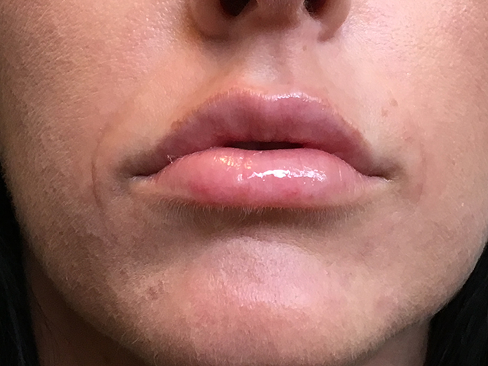 Photo Jan 10, 12 07 48 PM Close-up of lips showcasing a subtle enhancement, highlighting smooth texture and natural shine, relevant to Envie Skin and Body's lip enhancement treatments.