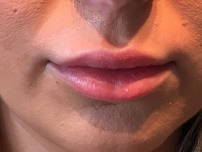 Photo Jan 13, 10 21 20 AM Close-up of enhanced lips showcasing smooth texture and natural gloss, highlighting the results of lip enhancement treatments at Envie Skin and Body.