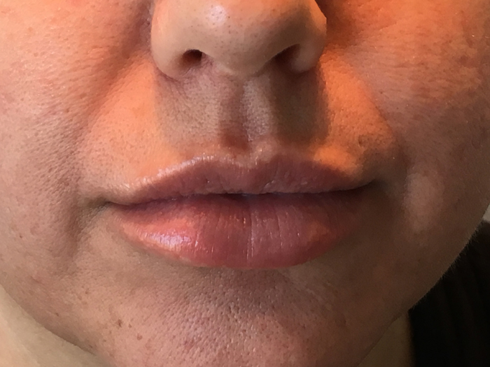 Photo Jan 20, 1 25 34 PM Close-up of enhanced lips showcasing a smooth and plump appearance, demonstrating results of lip enhancement treatments at Envie Skin and Body.