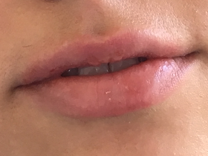 Photo Jan 26, 12 09 19 PM Close-up of lips showcasing subtle enhancement, highlighting natural fullness and smooth texture, relevant to lip enhancement treatments at Envie Skin and Body.
