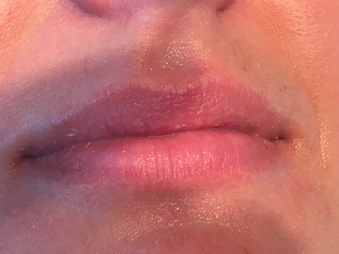 Photo Jan 27, 4 42 17 PM Close-up of enhanced lips showcasing smooth texture and natural color, illustrating results of lip enhancement treatment at Envie Skin and Body.