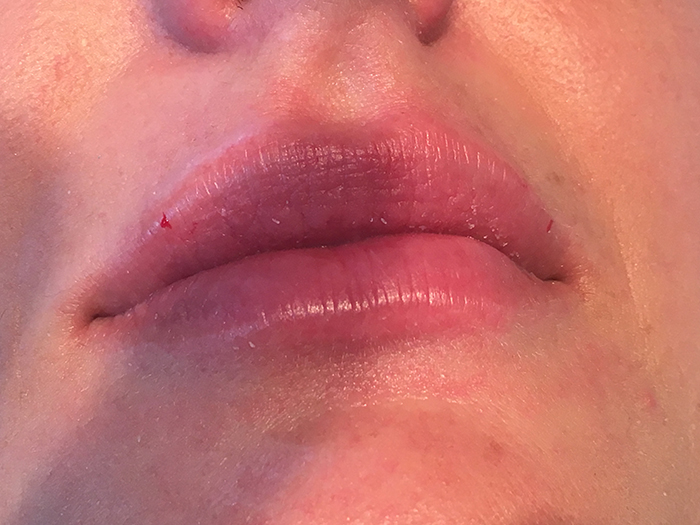 Photo Jan 27, 4 51 25 PM Close-up of enhanced lips showing natural fullness and subtle color, highlighting results of lip enhancement treatments at Envie Skin and Body.