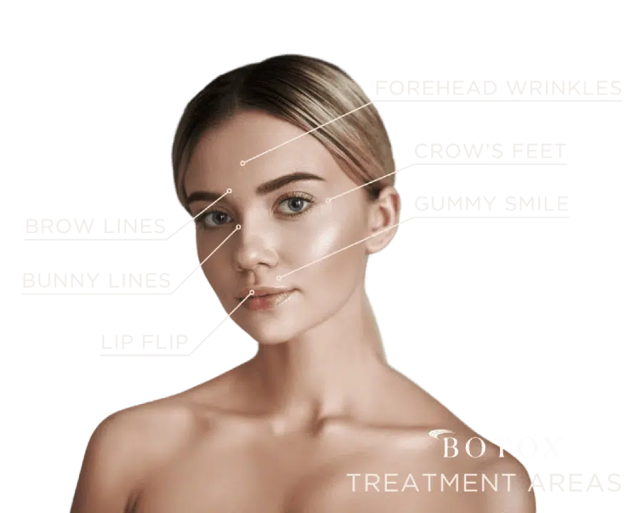 Vitalyc-Med-Spa-botox-treatment-areas.png Woman's face highlighting BOTOX® treatment areas, including frown lines, crow’s feet, and forehead lines, with labeled markers for aesthetic enhancement.