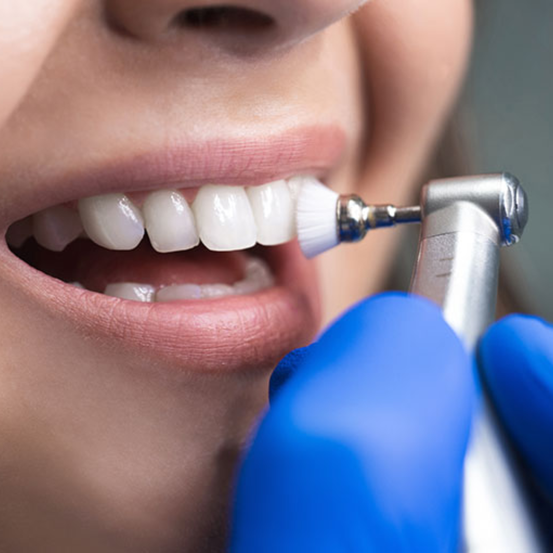 3 Close-up of a person receiving TheraGlow Teeth Whitening treatment, showcasing bright, white teeth and a dental tool applying whitening gel.