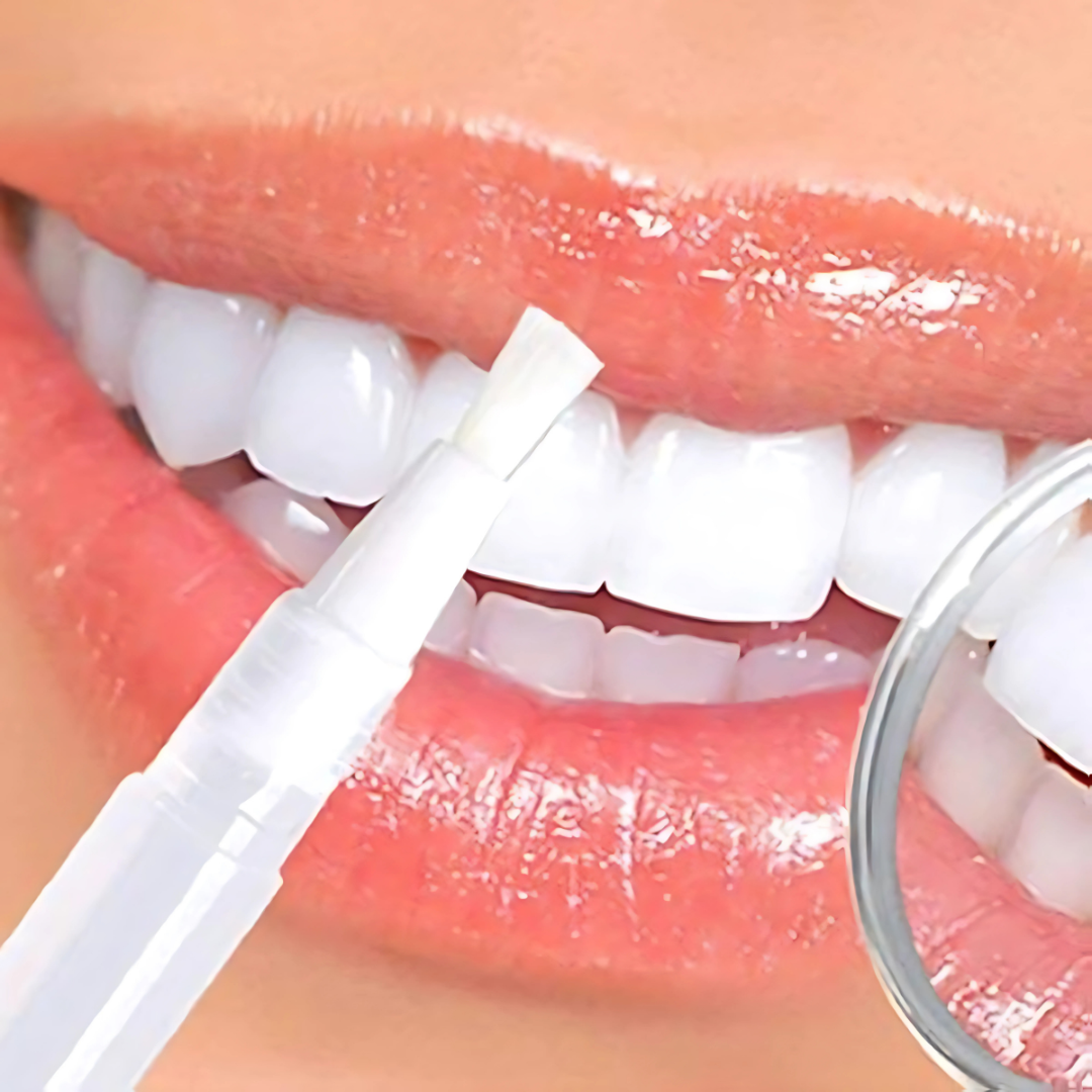 4 Teeth with bright white enamel and a touch-up pen applying whitening gel, showcasing TheraGlow Teeth Whitening system for effective, sensitive-free teeth whitening.